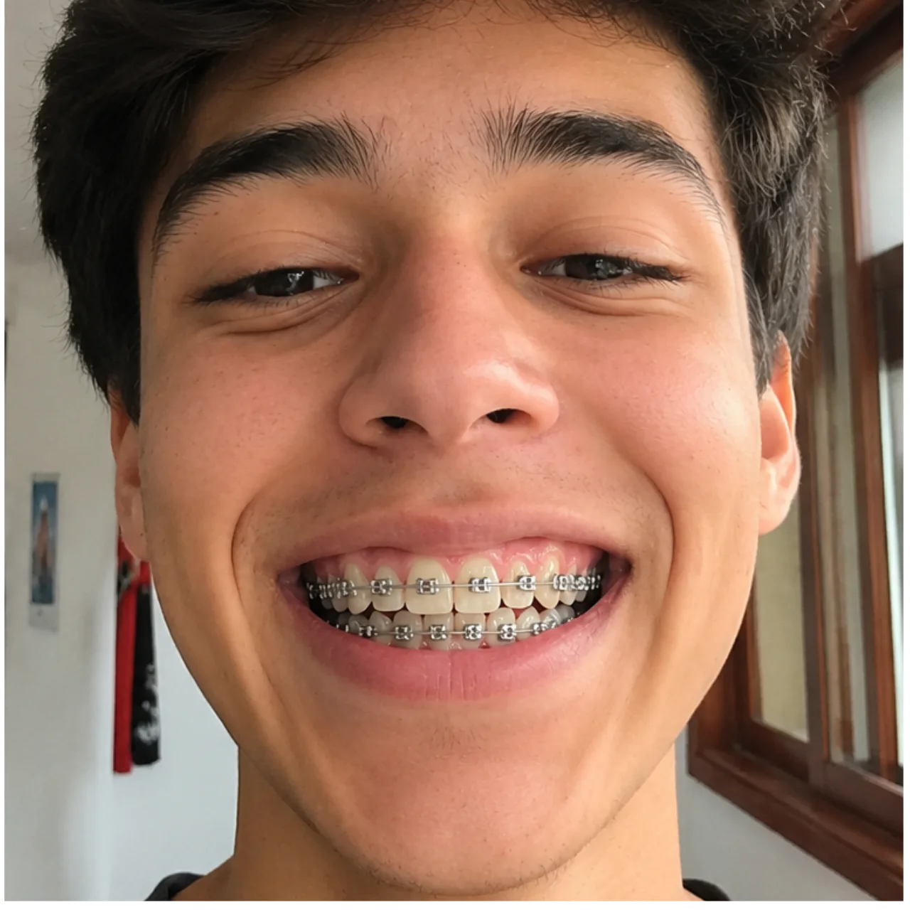 Después del tratamiento — caso 1